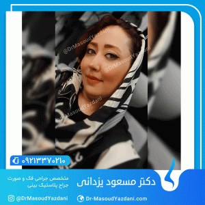جراحی زیبایی بینی در ایران