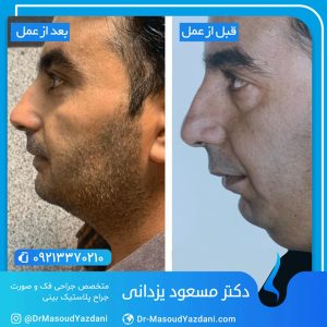 جراحی فک و صورت در تهران